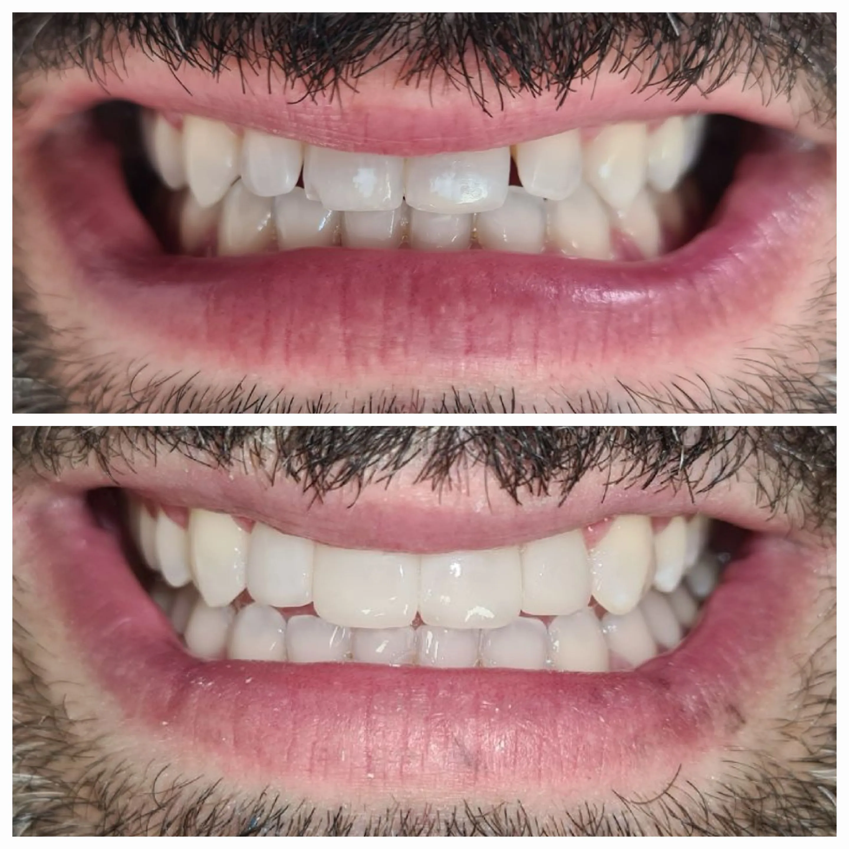 Antes e depois de tratamento odontológico 12